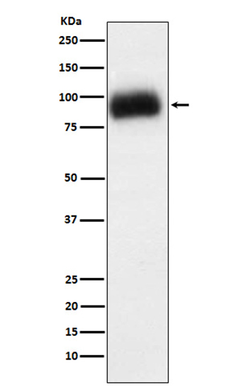 ADAM15 (11M11)兔单抗,ADAM15 (11M11) Rabbit Monoclonal Antibody