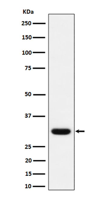 Adiponectin (5N3)兔单抗,Adiponectin (5N3) Rabbit Monoclonal Antibody