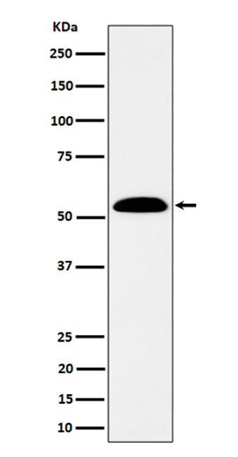 ALDH7A1 (14K11)兔单抗,ALDH7A1 (14K11) Rabbit Monoclonal Antibody