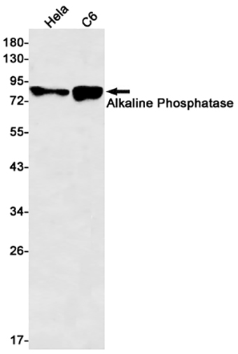 Alkaline Phosphatase (4C17)兔单抗,Alkaline Phosphatase (4C17) Rabbit Monoclonal Antibody