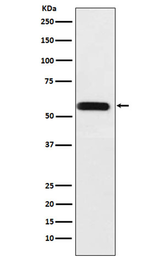 ANGPTL3 (1Z15)兔单抗,ANGPTL3 (1Z15) Rabbit Monoclonal Antibody