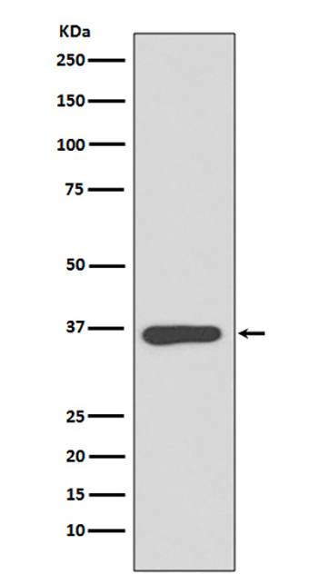 Annexin A10 (14O15)兔单抗,Annexin A10 (14O15) Rabbit Monoclonal Antibody