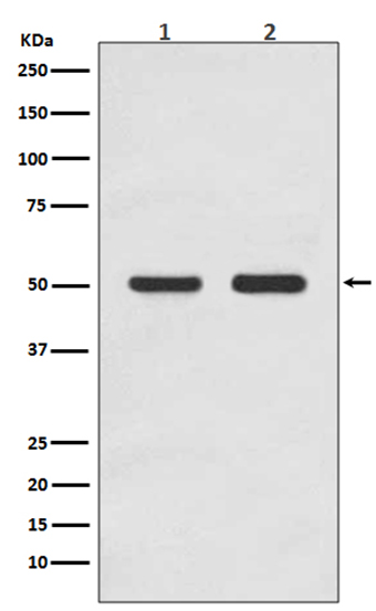 AP2M1 (5T7)兔单抗,AP2M1 (5T7) Rabbit Monoclonal Antibody