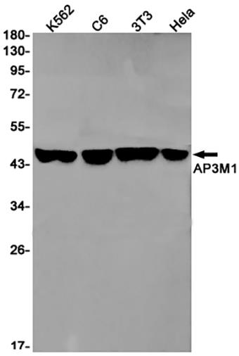 AP3M1 (16F4)兔单抗,AP3M1 (16F4) Rabbit Monoclonal Antibody