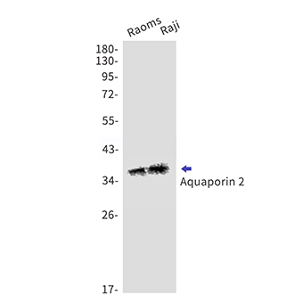 Aquaporin 2 (13E19)兔单抗,Aquaporin 2 (13E19) Rabbit Monoclonal Antibody
