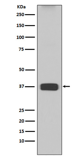 ARG1 (7H3)兔单抗,ARG1 (7H3) Rabbit Monoclonal Antibody