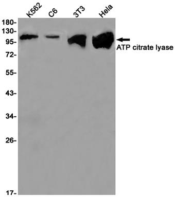 ATP citrate lyase  (8L17)兔单抗,ATP citrate lyase  (8L17) Rabbit Monoclonal Antibody