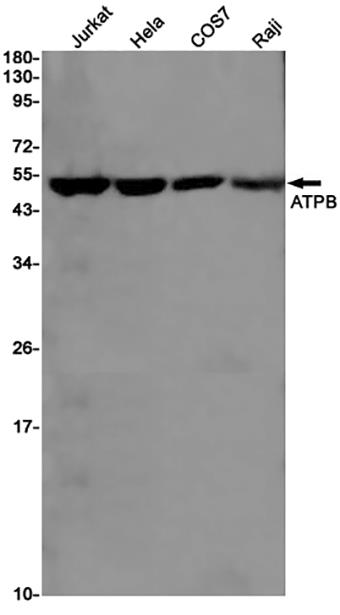 ATPB (19W10)兔单抗,ATPB (19W10) Rabbit Monoclonal Antibody