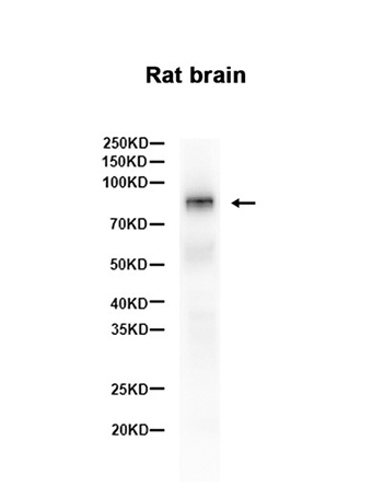 B Raf (9L5)兔单抗,B Raf (9L5) Rabbit Monoclonal Antibody