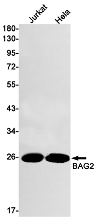BAG2 (9Z17)兔单抗,BAG2 (9Z17) Rabbit Monoclonal Antibody