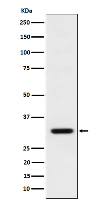 BCL2L12 (18T13)兔单抗,BCL2L12 (18T13) Rabbit Monoclonal Antibody