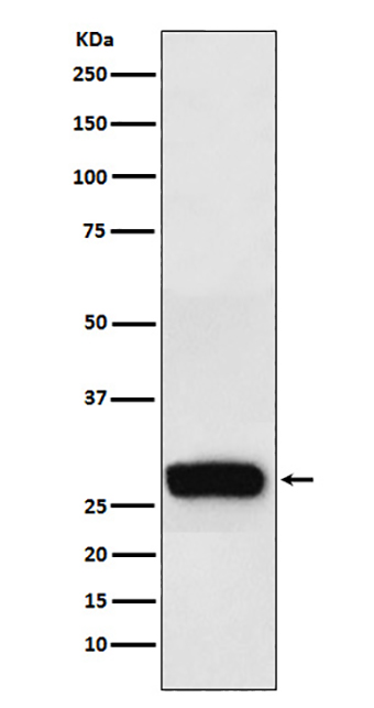 beta Casein (1J13)兔单抗,beta Casein (1J13) Rabbit Monoclonal Antibody