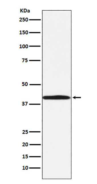 BGAT (19J2)兔单抗,BGAT (19J2) Rabbit Monoclonal Antibody