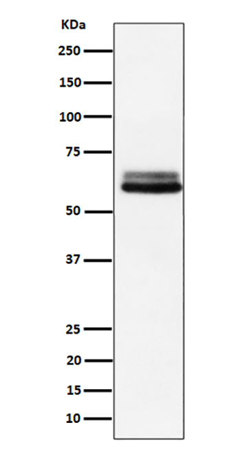 BIN1 (14G10)兔单抗,BIN1 (14G10) Rabbit Monoclonal Antibody
