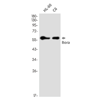 Caldesmon (3X14)兔单抗,Caldesmon (3X14) Rabbit Monoclonal Antibody