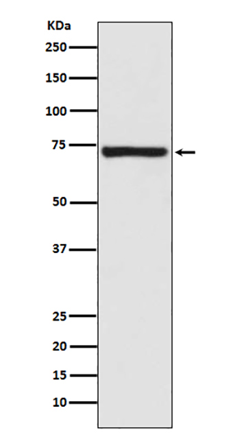 Calpain 1 (19K17)兔单抗,Calpain 1 (19K17) Rabbit Monoclonal Antibody