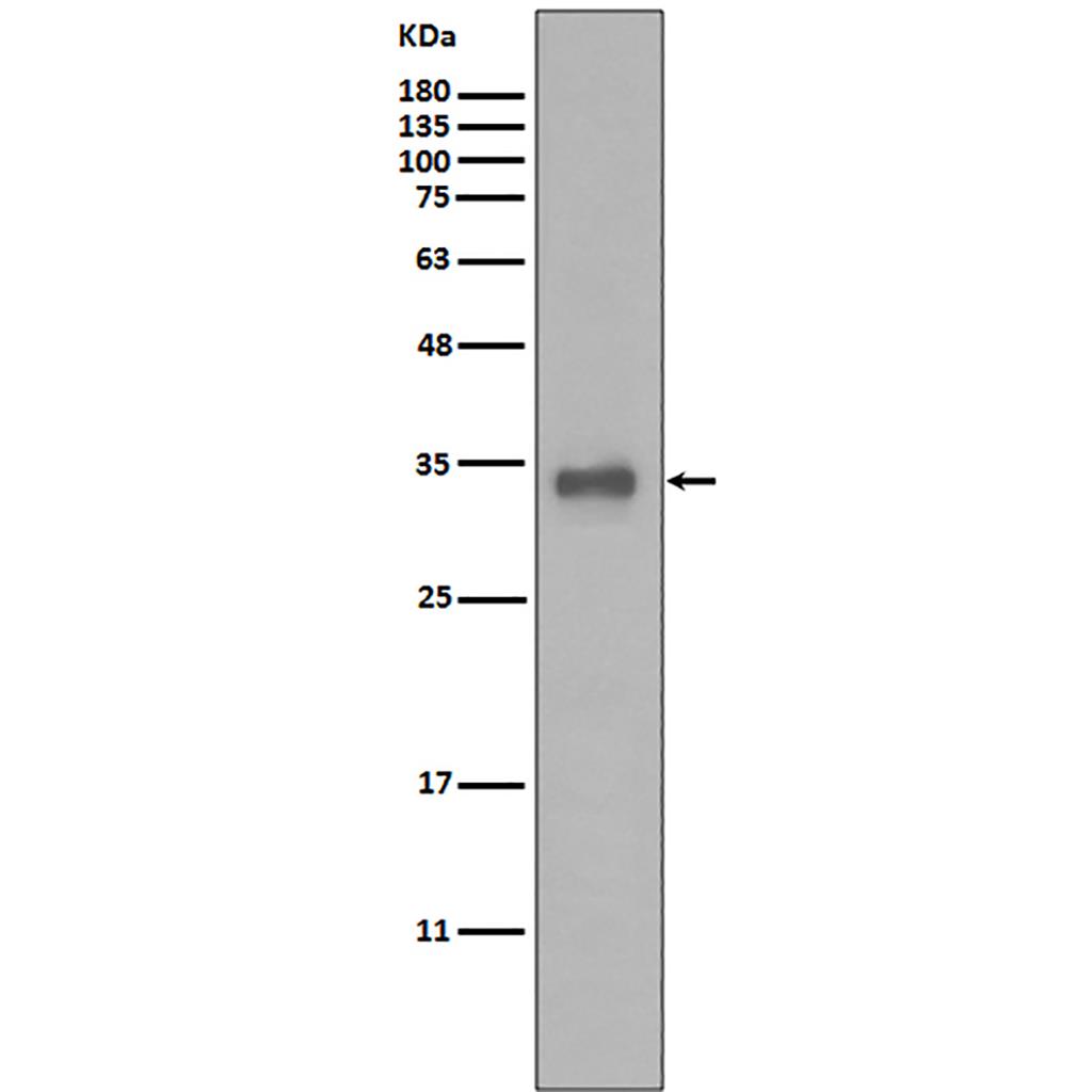 Calponin  (6N15)兔单抗,Calponin  (6N15) Rabbit Monoclonal Antibody