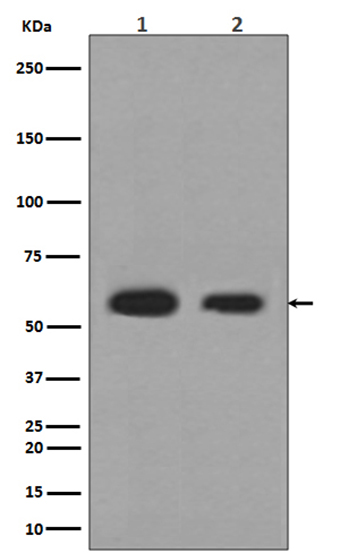 Calreticulin (3B4)兔单抗,Calreticulin (3B4) Rabbit Monoclonal Antibody