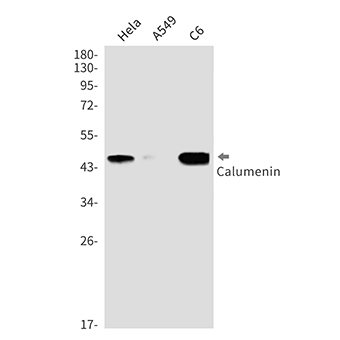 Calumenin (14E19)兔单抗,Calumenin (14E19) Rabbit Monoclonal Antibody
