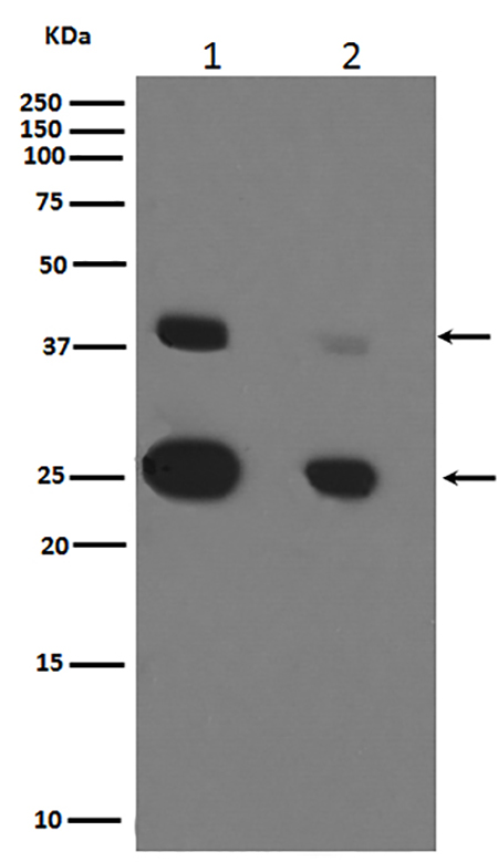 Cathepsin D (11F19)兔单抗,Cathepsin D (11F19) Rabbit Monoclonal Antibody