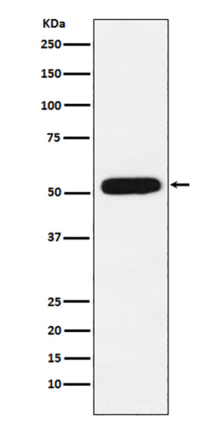 CBX4 (10P4)兔单抗,CBX4 (10P4) Rabbit Monoclonal Antibody
