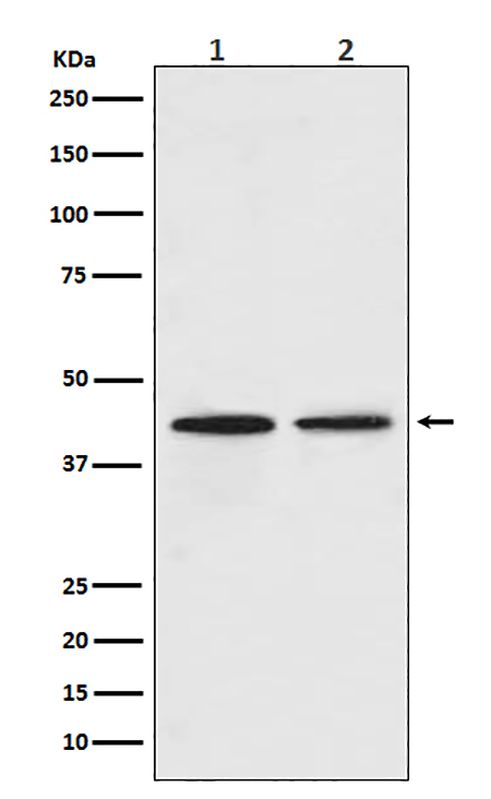 CCR9 (11E6)兔单抗,CCR9 (11E6) Rabbit Monoclonal Antibody
