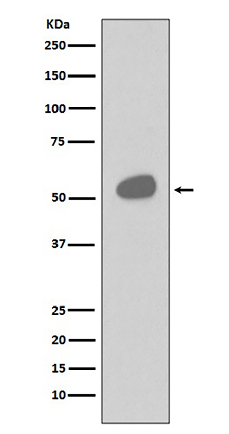 CD14 (16H16)兔单抗,CD14 (16H16) Rabbit Monoclonal Antibody