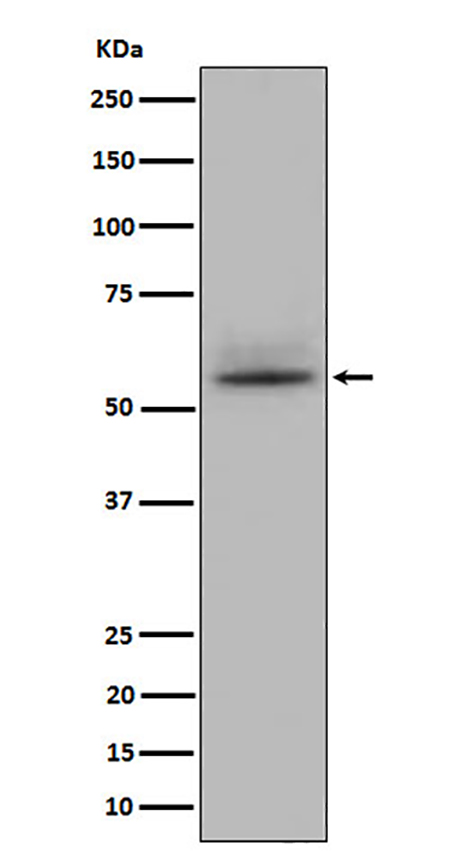 CD147 (8C17)兔单抗,CD147 (8C17) Rabbit Monoclonal Antibody