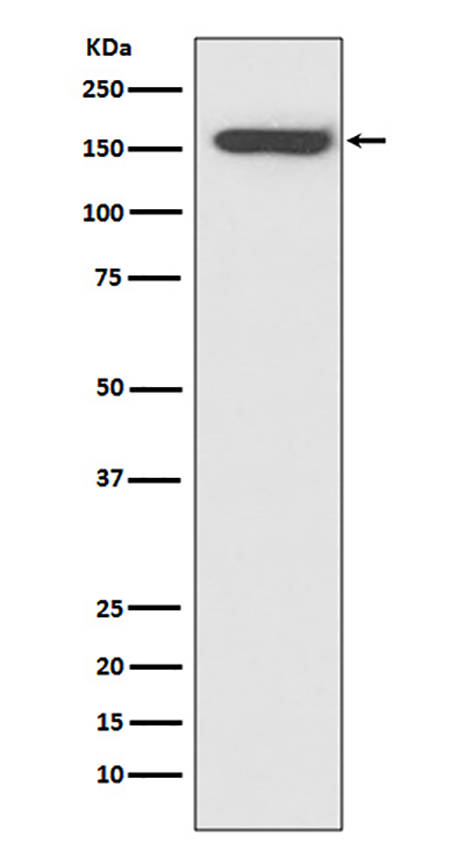 CD21 (14S6)兔单抗,CD21 (14S6) Rabbit Monoclonal Antibody