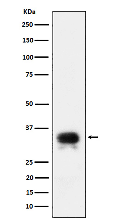 CD24 (11S3)兔单抗,CD24 (11S3) Rabbit Monoclonal Antibody