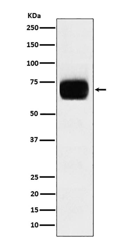 CD33 (18N8)兔单抗,CD33 (18N8) Rabbit Monoclonal Antibody