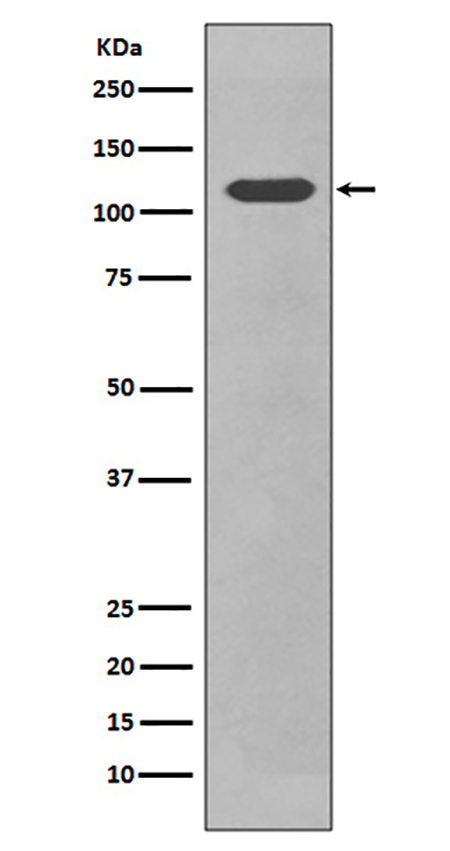 CD34 (7Z7)兔单抗,CD34 (7Z7) Rabbit Monoclonal Antibody