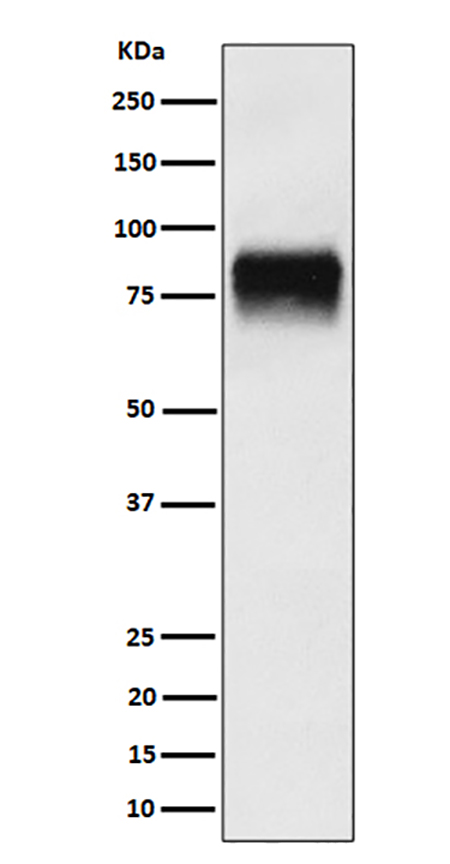 CD44 (19J7)兔单抗,CD44 (19J7) Rabbit Monoclonal Antibody
