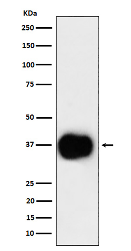 CD79b (1O8)兔单抗,CD79b (1O8) Rabbit Monoclonal Antibody