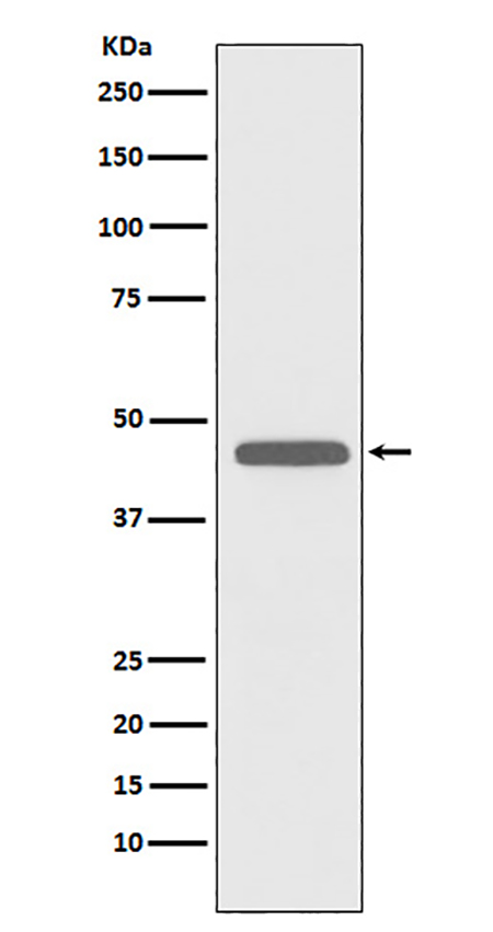 CD83 (7K14)兔单抗,CD83 (7K14) Rabbit Monoclonal Antibody
