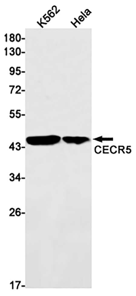 CECR5 (17M19)兔单抗,CECR5 (17M19) Rabbit Monoclonal Antibody