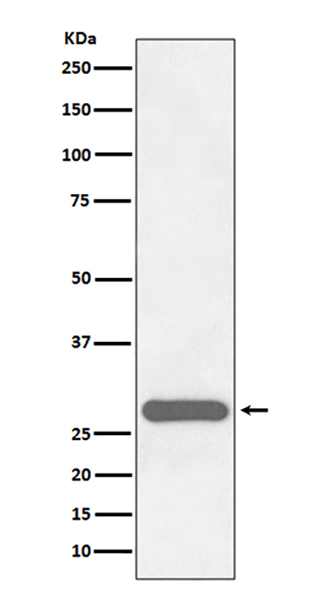 CITED2 (17H2)兔单抗,CITED2 (17H2) Rabbit Monoclonal Antibody