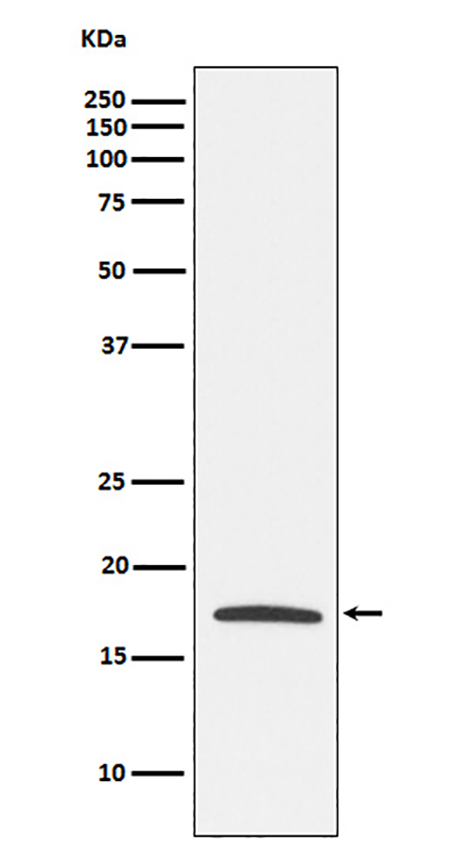 Claudin 4  (6G15)兔单抗,Claudin 4  (6G15) Rabbit Monoclonal Antibody