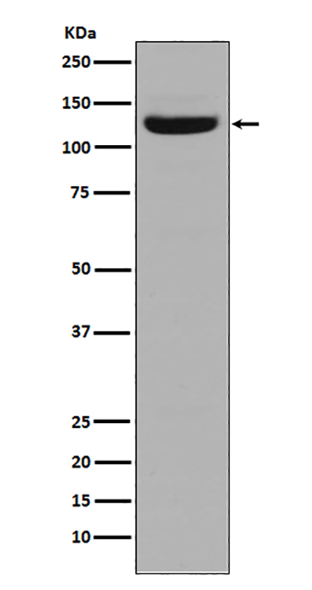 Collagen I (7F14)兔单抗,Collagen I (7F14) Rabbit Monoclonal Antibody