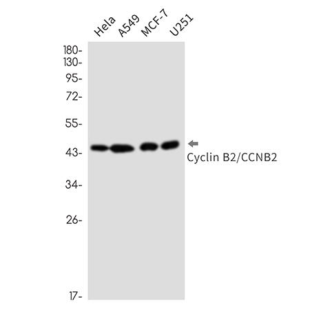 Cyclin B2 (18U13)兔单抗,Cyclin B2 (18U13) Rabbit Monoclonal Antibody