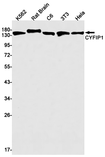 CYFIP1 (15Y6)兔单抗,CYFIP1 (15Y6) Rabbit Monoclonal Antibody