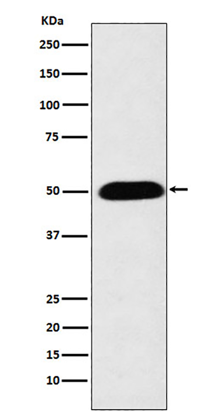 CYP27A1 (5H15)兔单抗,CYP27A1 (5H15) Rabbit Monoclonal Antibody