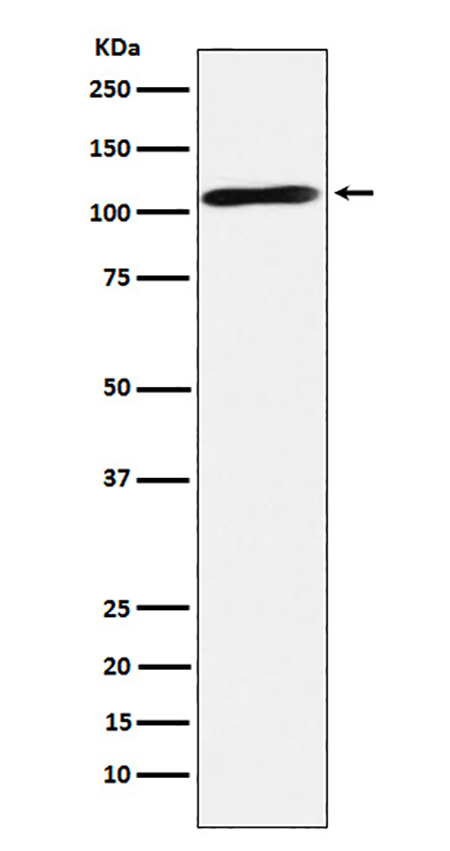 Epac2 (19F17)兔单抗,Epac2 (19F17) Rabbit Monoclonal Antibody