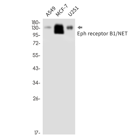 Eph receptor B1 (19N17)兔单抗,Eph receptor B1 (19N17) Rabbit Monoclonal Antibody
