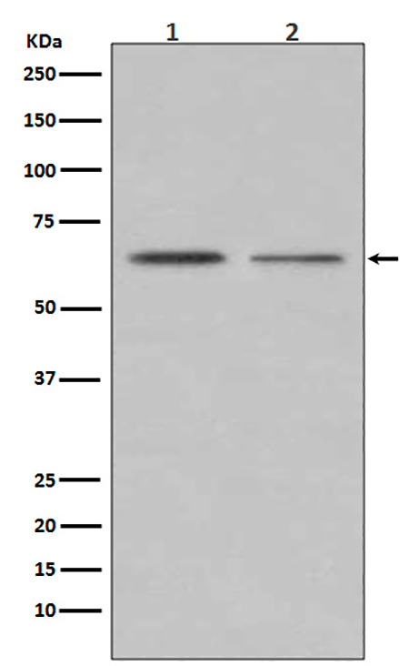 ER alpha (12J19)兔单抗,ER alpha (12J19) Rabbit Monoclonal Antibody