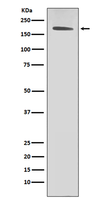 ErbB2 (HER2) (4J7)兔单抗,ErbB2 (HER2) (4J7) Rabbit Monoclonal Antibody