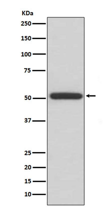 ERp57 (7K11)兔单抗,ERp57 (7K11) Rabbit Monoclonal Antibody