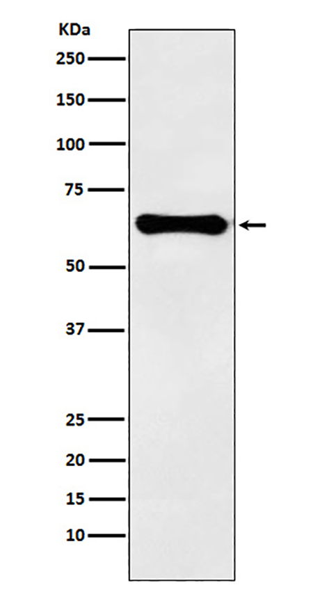 Factor IX  (1L7)兔单抗,Factor IX  (1L7) Rabbit Monoclonal Antibody