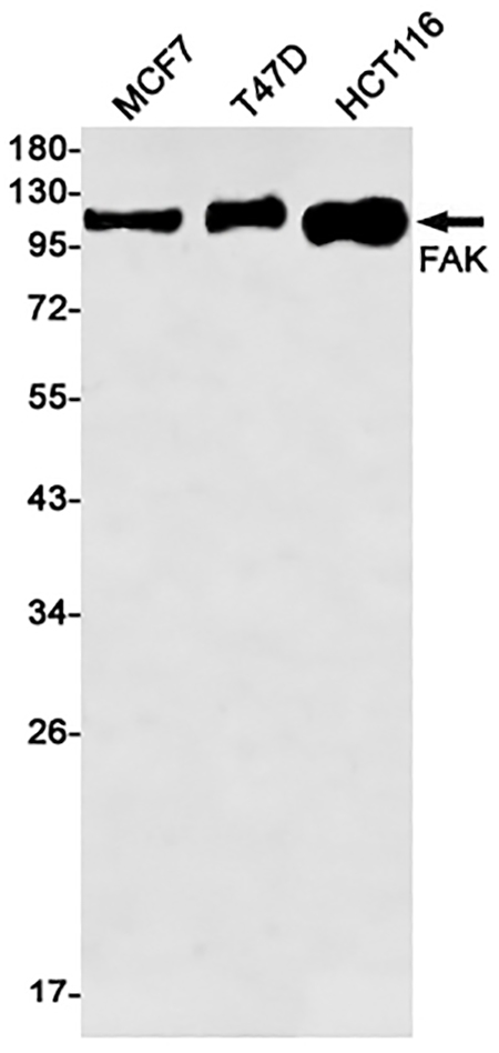 FAK (14V18)兔单抗,FAK (14V18) Rabbit Monoclonal Antibody