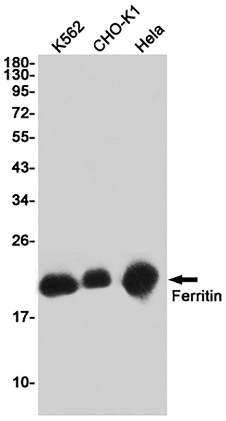 Ferritin (18K15)兔单抗,Ferritin (18K15) Rabbit Monoclonal Antibody